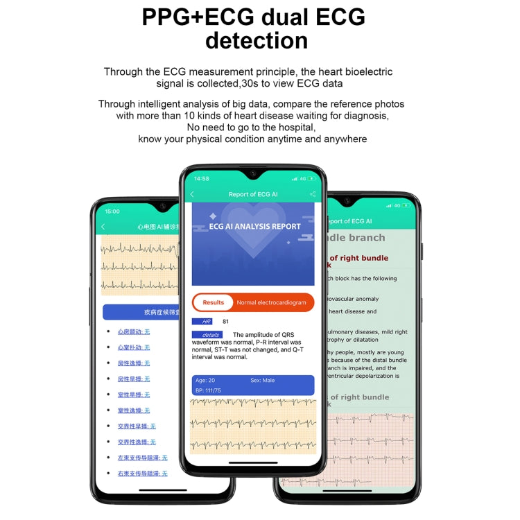 E86 1.7 inch TFT Color Screen IP68 Waterproof Smart Watch, Support Blood Oxygen Monitoring / Body Temperature Monitoring / AI Medical Diagnosis, Style: TPU Strap(Blue) by bashfashion