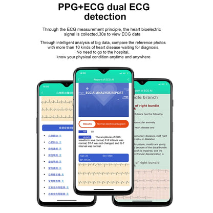 E86 1.7 inch TFT Color Screen IP68 Waterproof Smart Watch, Support Blood Oxygen Monitoring / Body Temperature Monitoring / AI Medical Diagnosis, Style: TPU Strap(Blue) by bashfashion